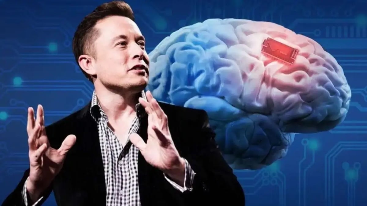 musk