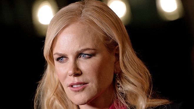 _103882418_kidman