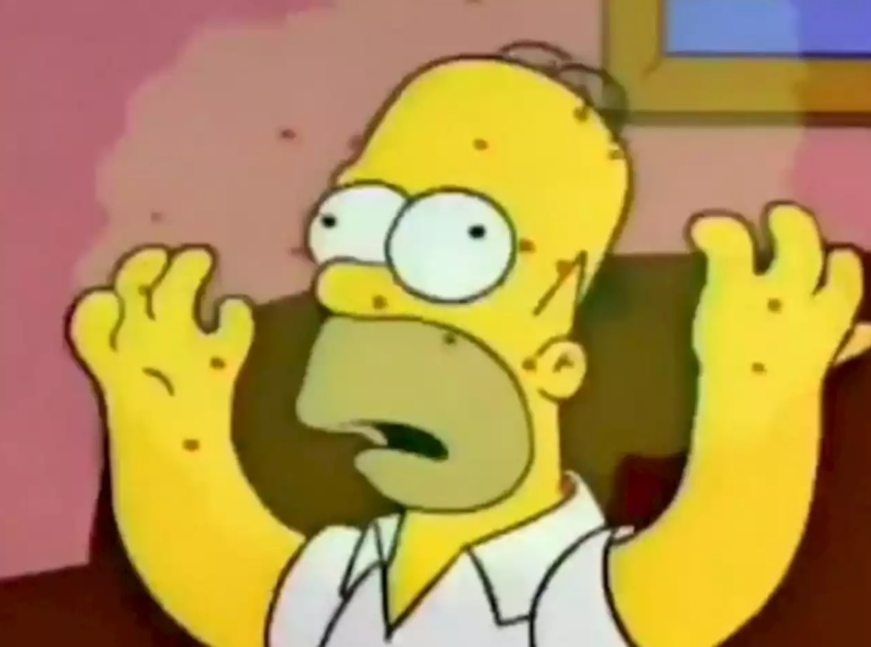 Simpson