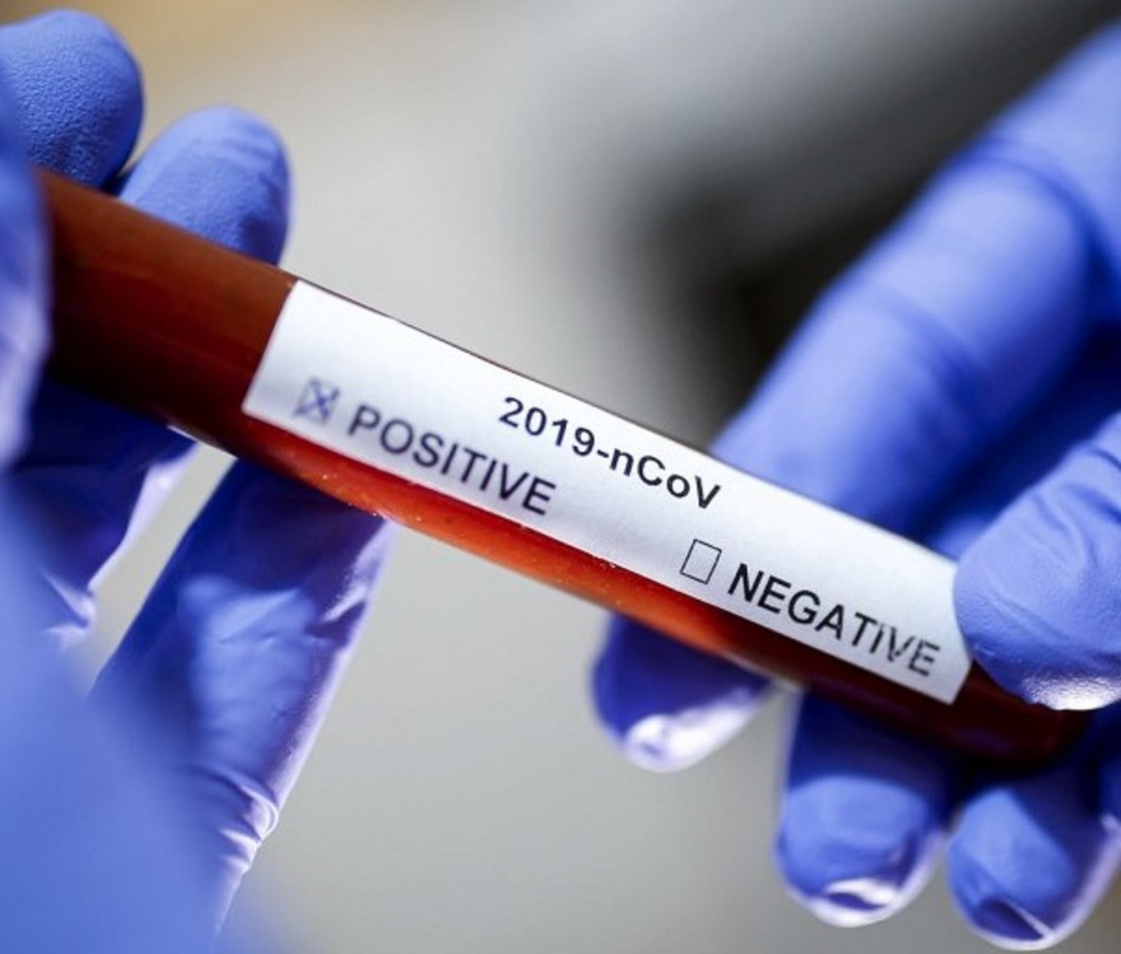 Coronavirus-positivo