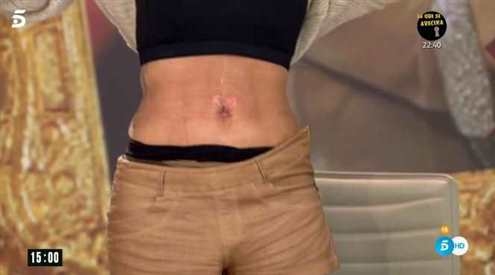 marta-lopez-abdomen_0a7dec9c_495x275