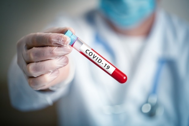 corona-virus-lab-cientifico-realizar-analisis-sangre-nuevo-epidemia-coronavirus-2019-ncov-fondo-espacio-copia-horizontal_99293-828