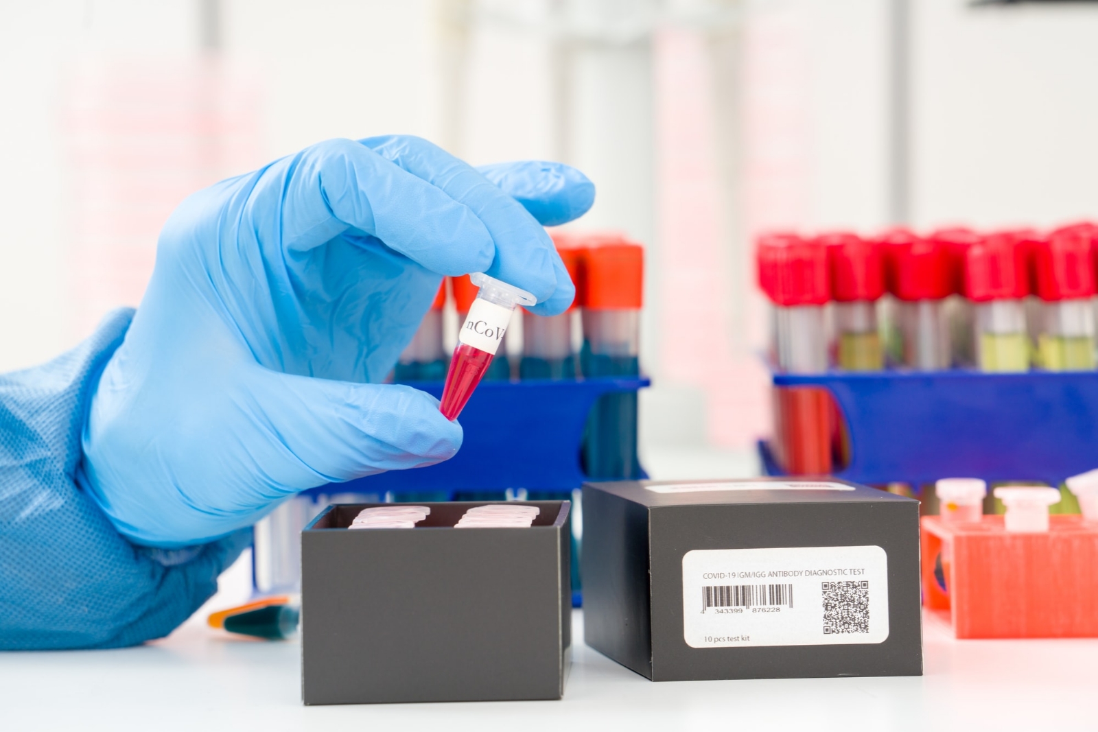 coronavirus-covid-19-pruebas-serológicas-América-Latina-Coronavirus-tests-anticuerpos-min