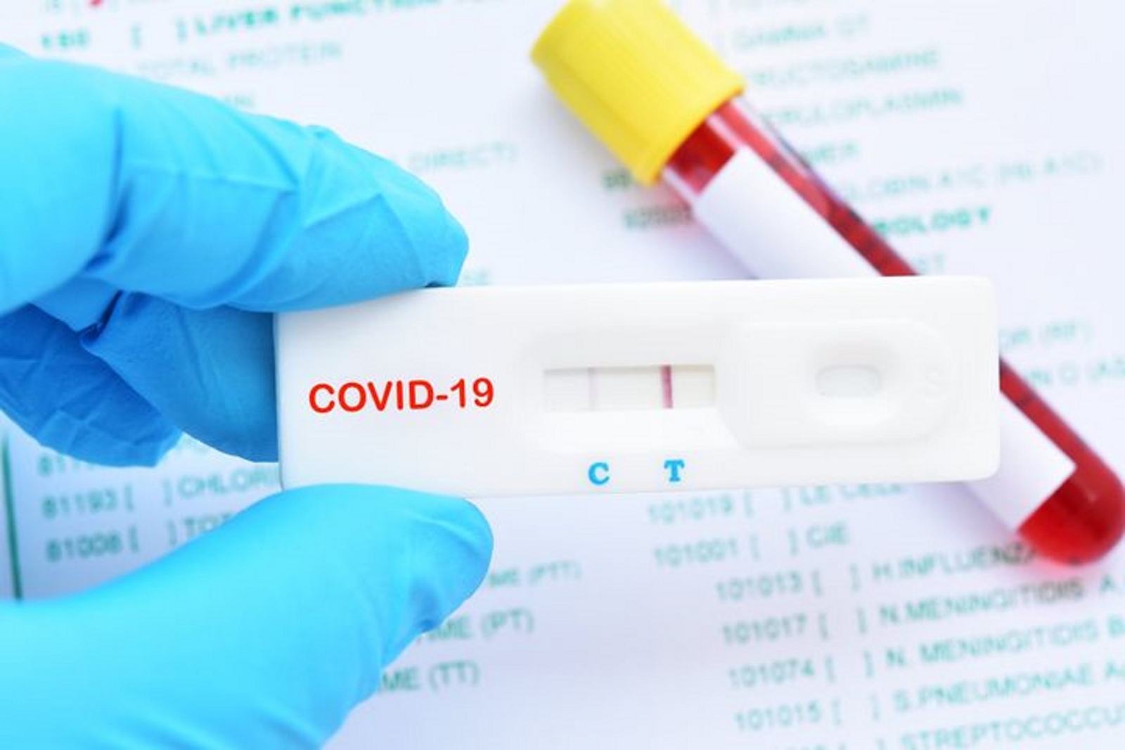 Test-coronavirus-en-utrera