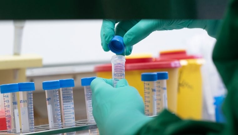 GERMANY-HEALTH-VIRUS_50940241
