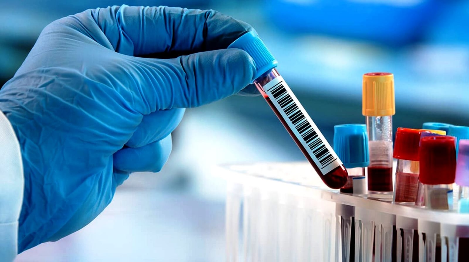 TEST-SEROLOGICOS-CORONAVIRUS