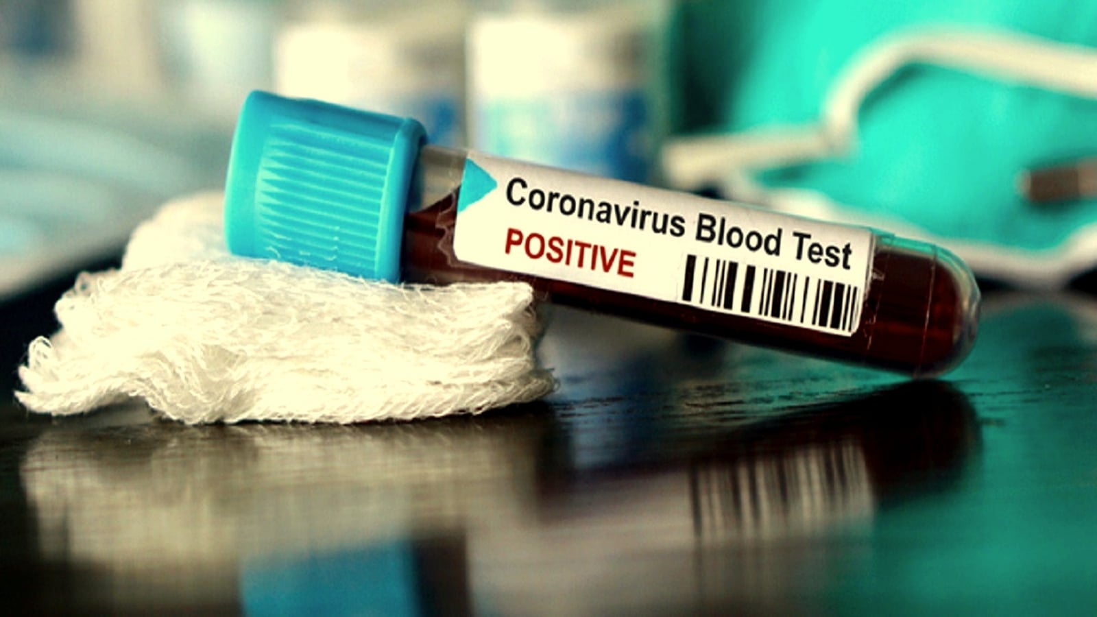 Estudio-de-sangre-que-informa-un-caso-de-coronavirus-positivo