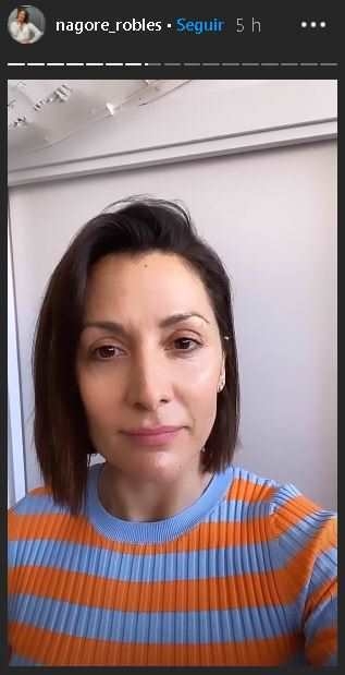 nagore-robles_en IG por la operación de nariz