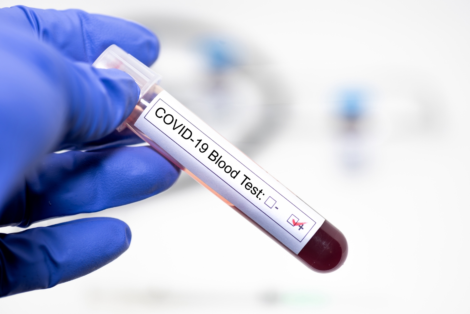 www.minutoneuquen.com coronavirus 1