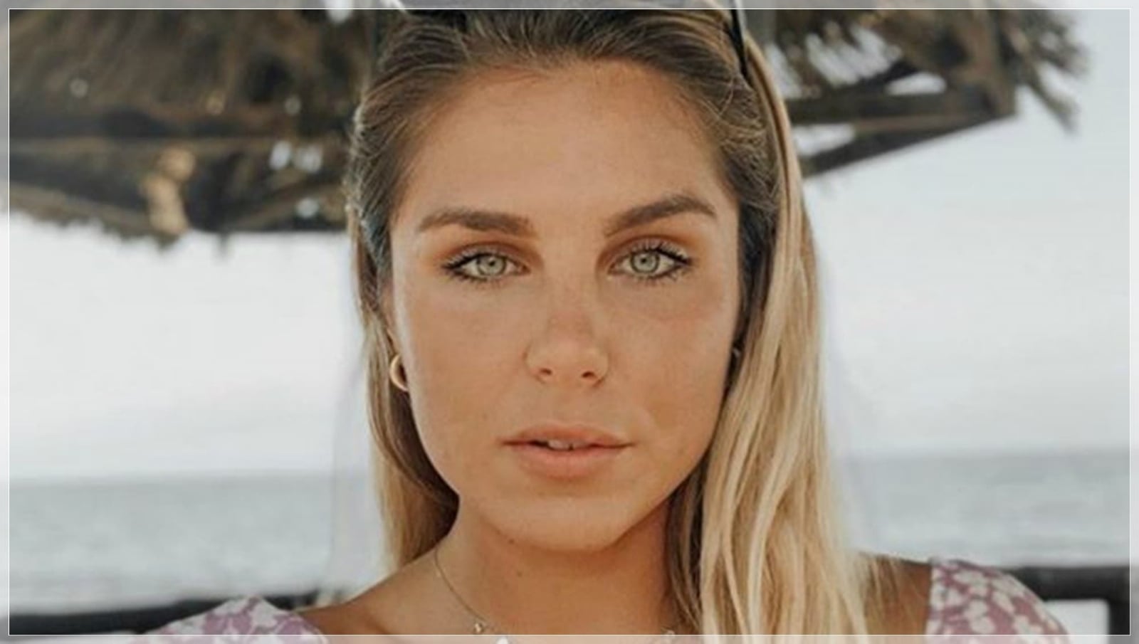La-impactante-foto-de-Ivana-Icardi-SV-tras-sufrir-un-pequeño-incidente-en-sus-labios