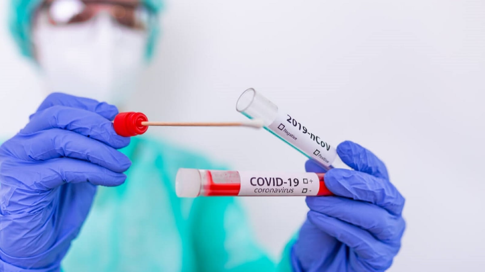 Más-de-15-mil-resultados-de-pruebas-Covid-19-no-se-han-entregado