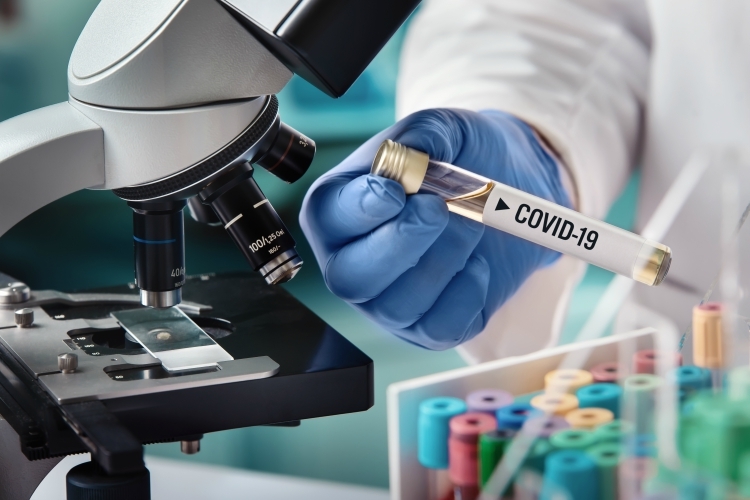Equipo-de-diagnostico-de-COVID-19-en-minutos-GR
