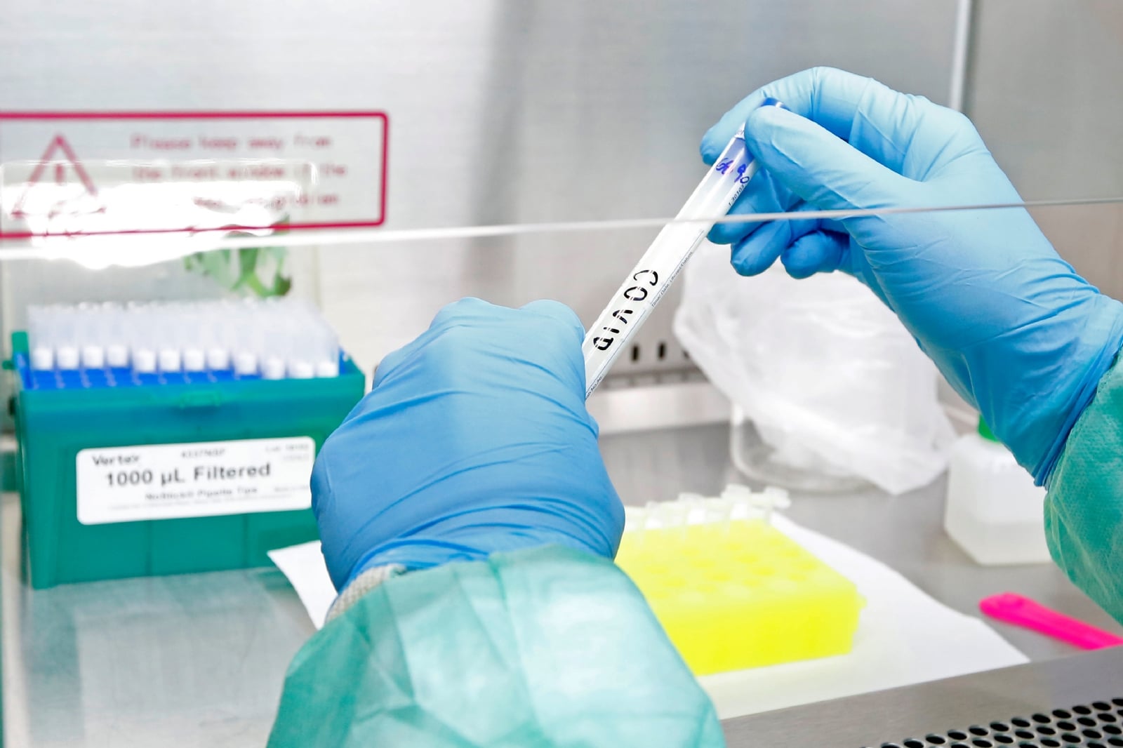 Roca-Laboratorio-muestras-COVID-Coronavirus-Juan-Thomes-28