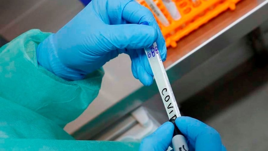 roca-laboratorio-muestras-covid-coronavirus-juan-thomes-7