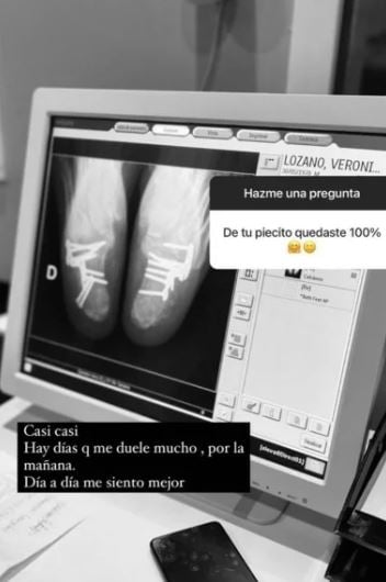 pies vero lozano