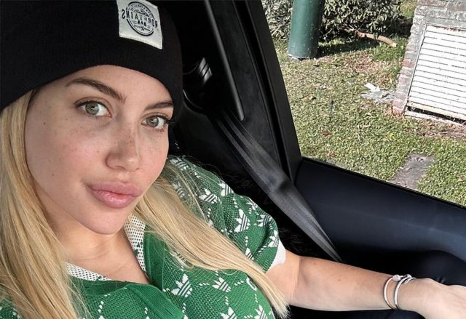 Marcela-Tauro-dio-detalles-del-tratamiento-de-Wanda-Nara