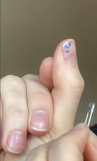 18