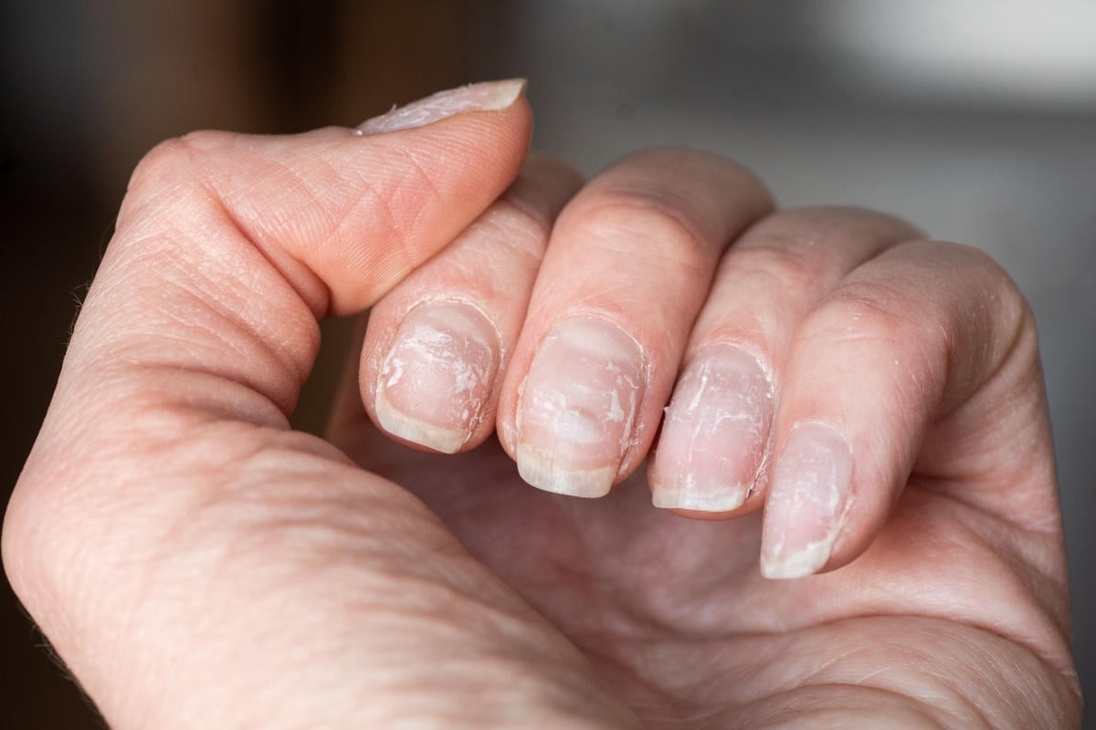 Uñas