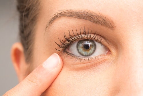 mujer-con-ojeras