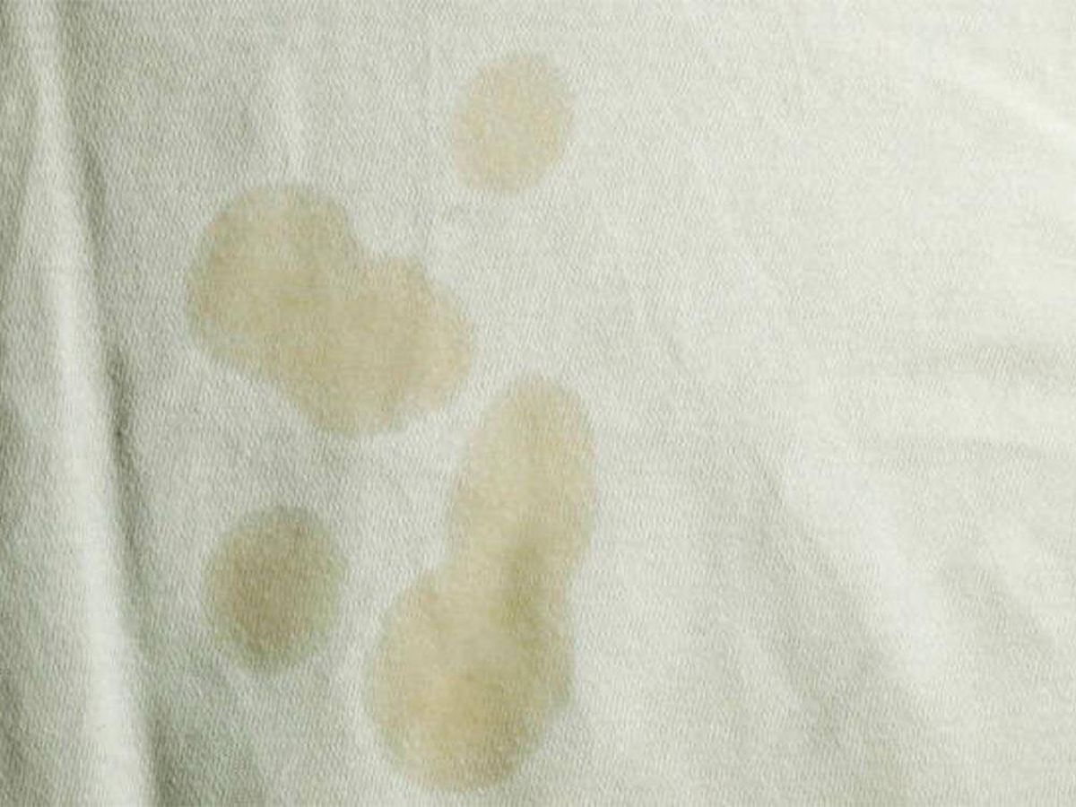 manchas 1