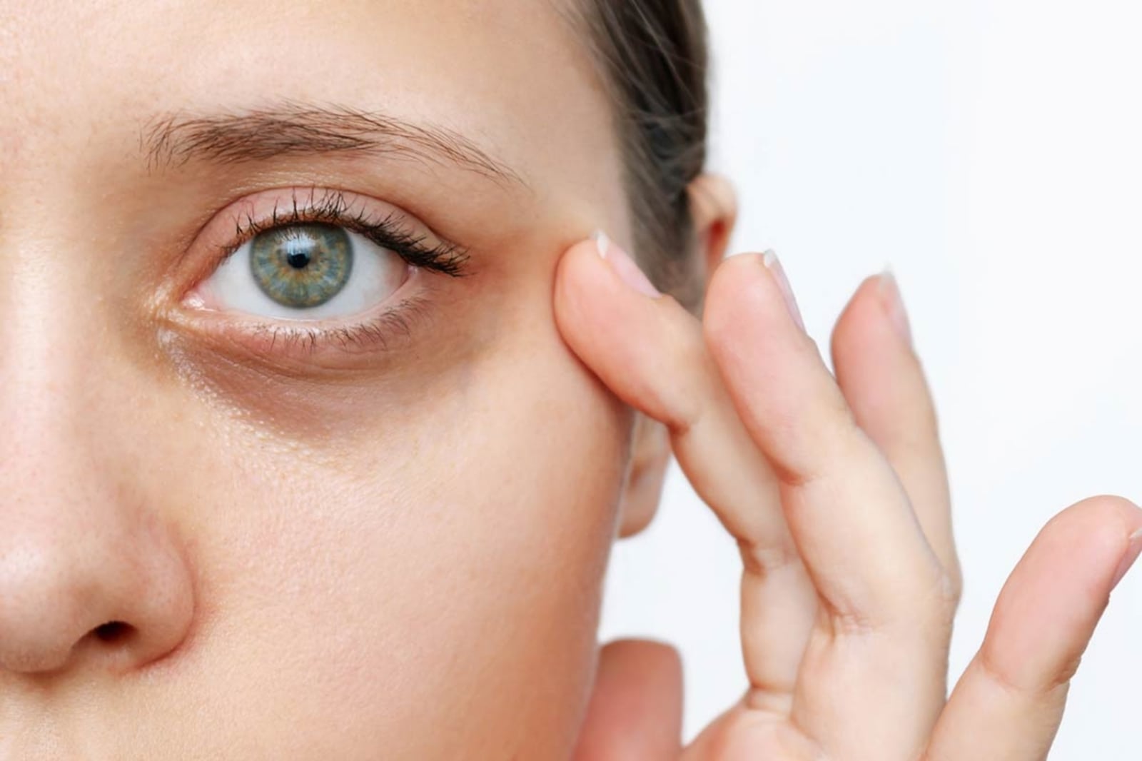 tipos-ojeras