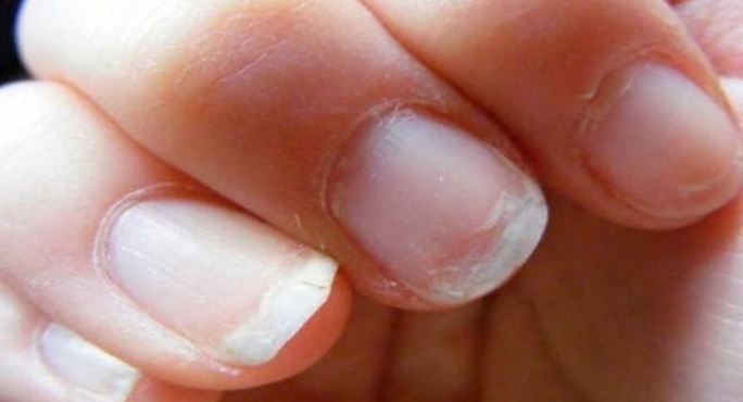 UÑAS9999