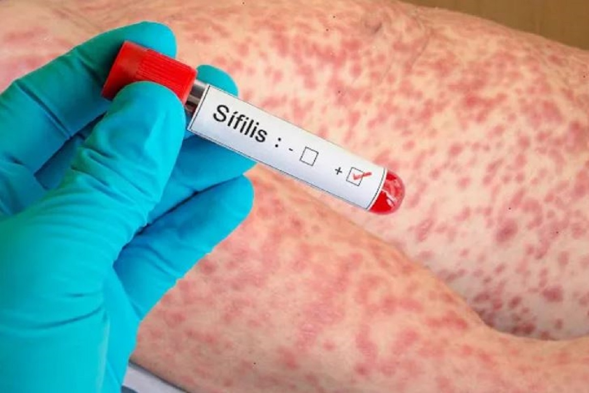 sifilis velez lab