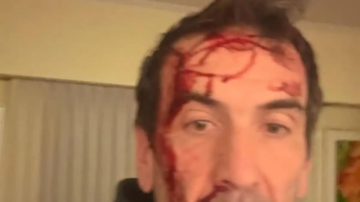 pablo cervi cara ensangrentada