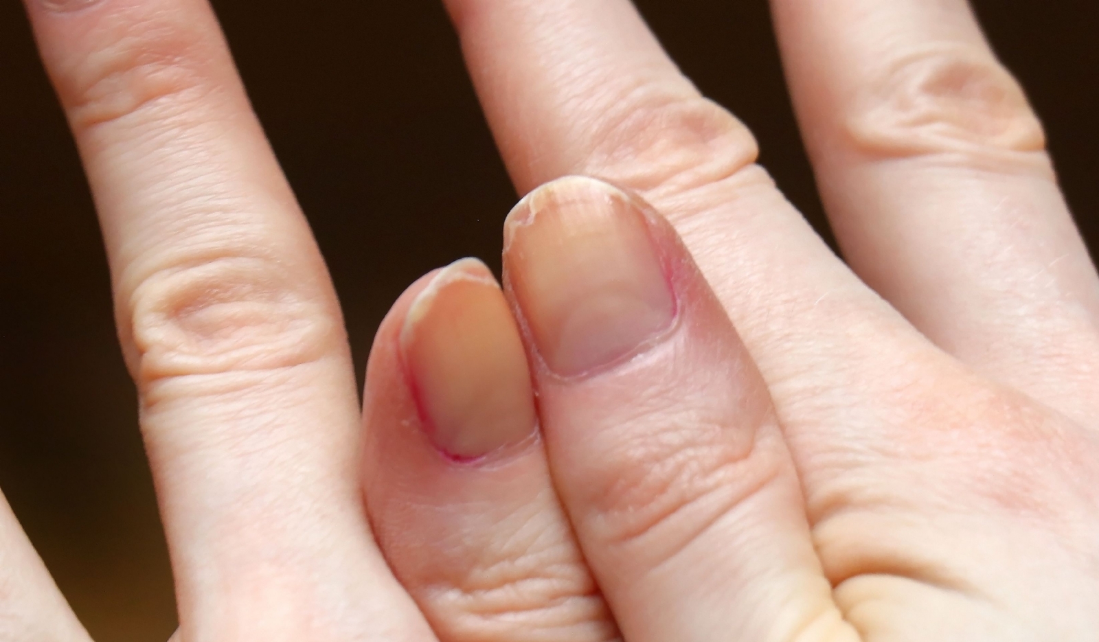 Uñas
