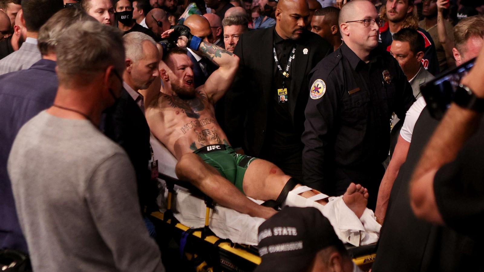 210711204503-conor-mcgregor-injury-full-169