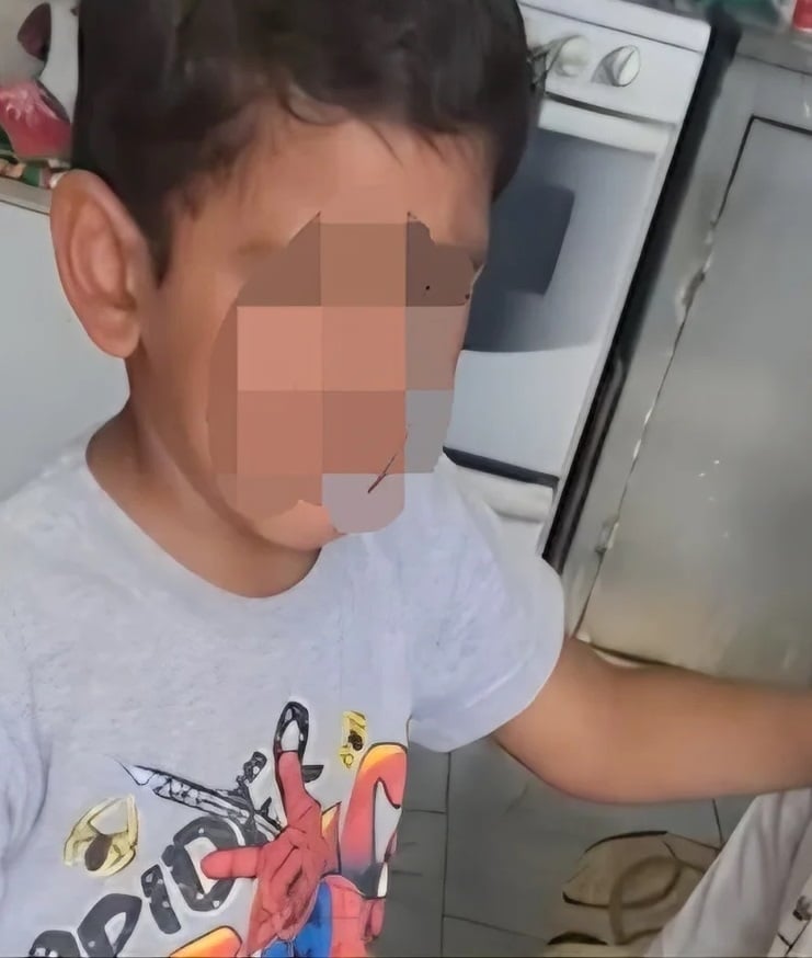 intena caso