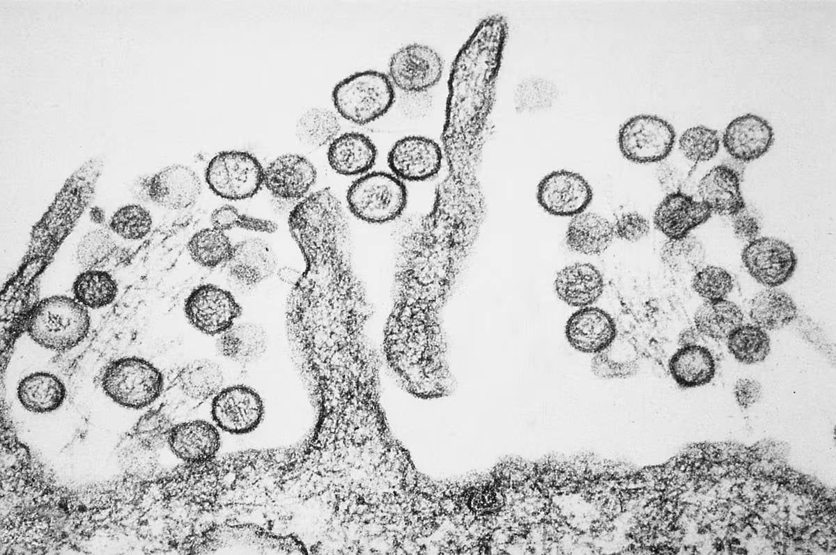 hantavirus al microscopio